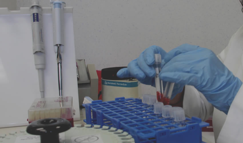 El resultado esperado es que la persona vacunada active su sistema de defensas, que éste produzca proteínas lla­madas anticuerpos y que és­tos sean capaces de bloquear el VIH