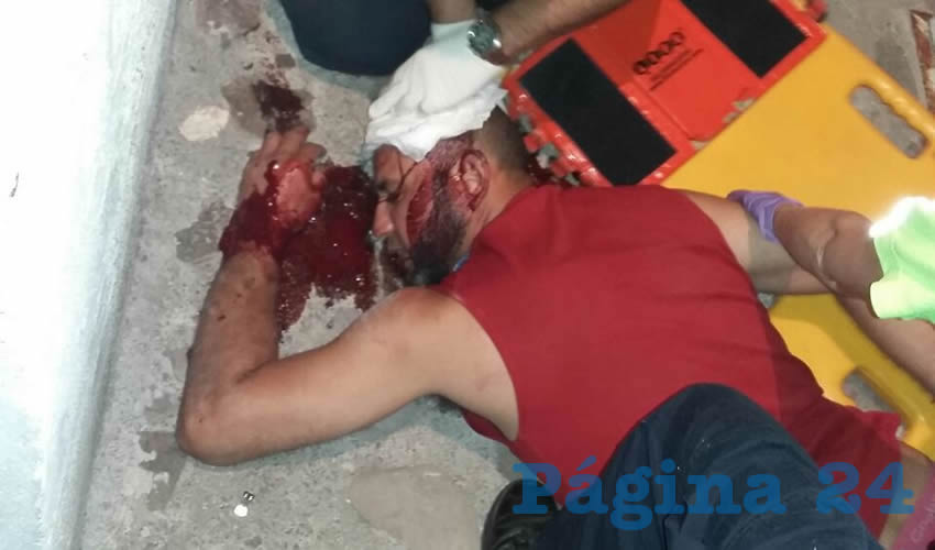 Grave lesión en la cabeza sufrió Daniel de los Santos Gallegos