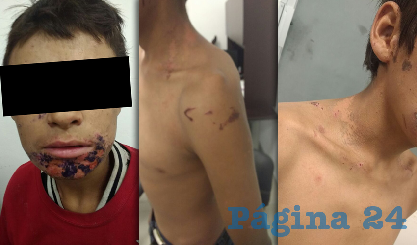 La v&iacute;ctima, que fue secuestrada en mayo del a&ntilde;o pasado, fue golpeado en m&uacute;ltiples ocasiones y sometido a tortura: sus captores le quemaban el rostro con &aacute;cido muri&aacute;tico