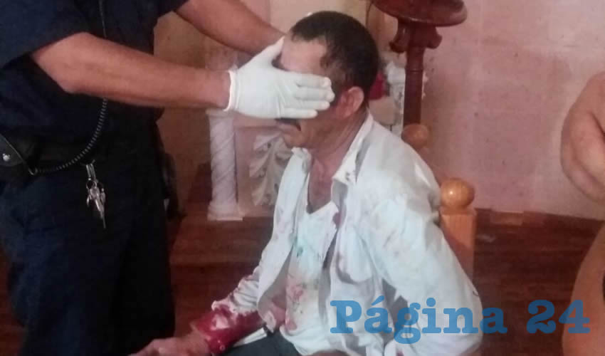 J. Jesús Aguilar Báez sufrió un fuerte golpe en el rostro