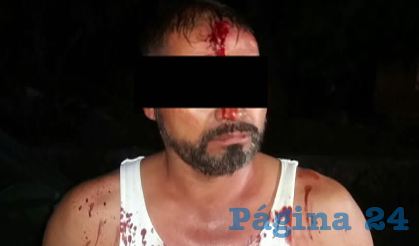 Pedro atacó a la joven con un rifle