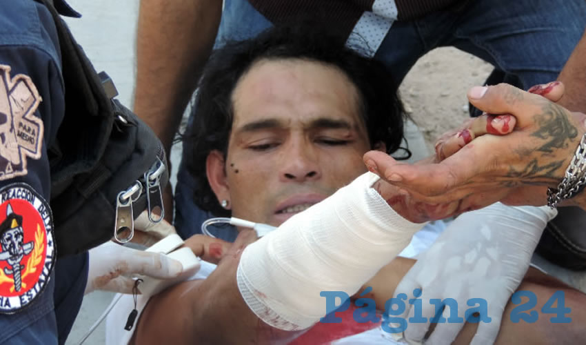 Leonardo González Ramírez con su brazo herido