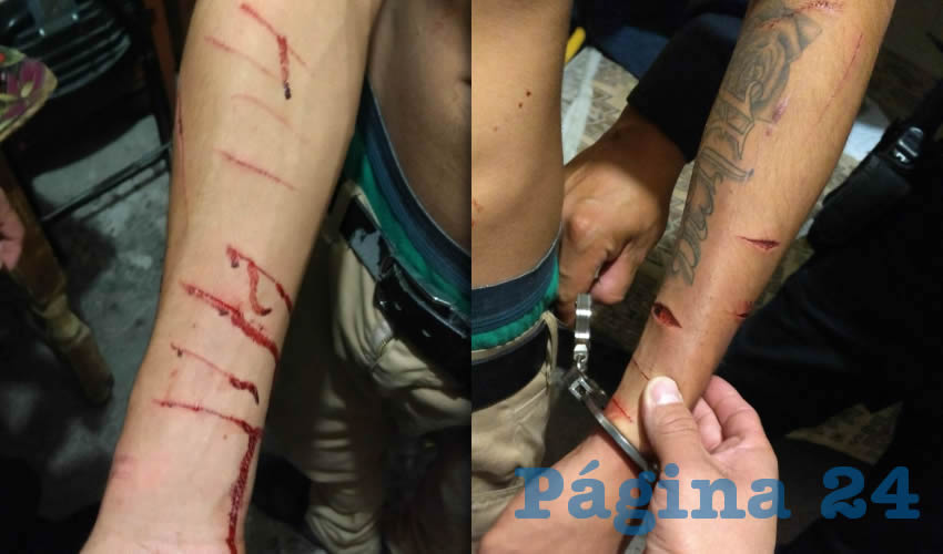 Los cortes en el brazo que se provoc&oacute; Joseph Michell &ldquo;N&rdquo; &ldquo;N&rdquo;