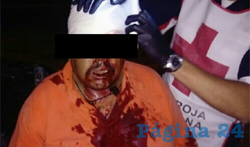 El pillo Rosario fue herido en el rostro