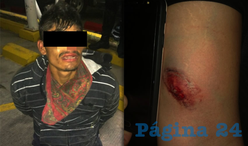 El feroz Antonio le provoc&oacute; una herida al uniformado Omar