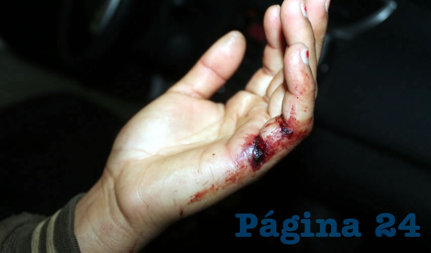 Una de las recientes heridas que sufrió Cecilia a manos de su consanguíneo
