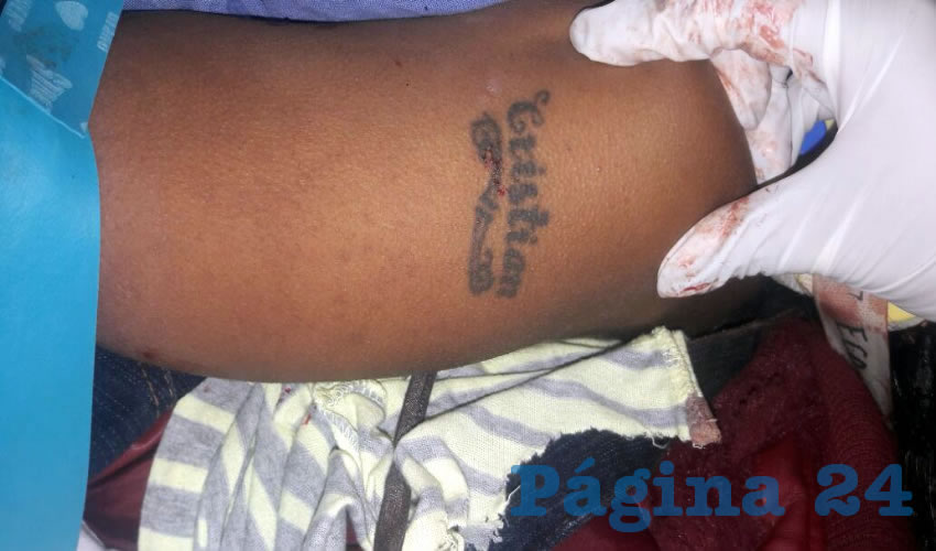 Uno de los tatuajes que tiene la f&eacute;mina en una de sus extremidades