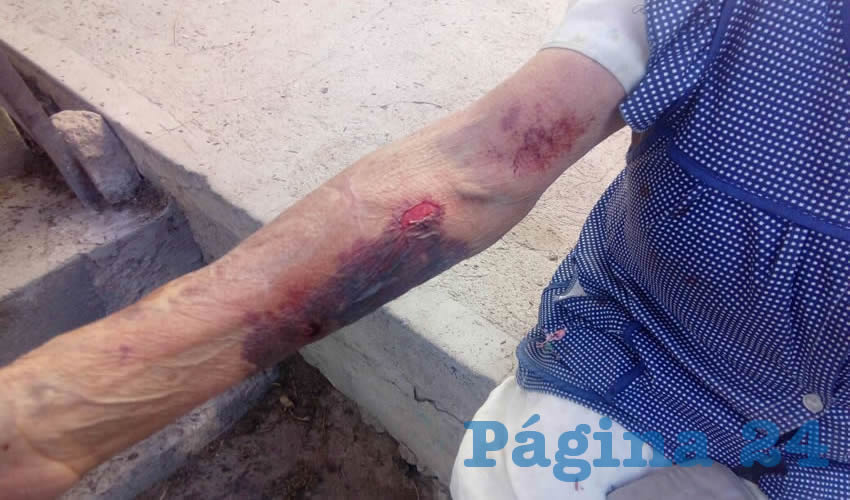 Una de las heridas que sufri&oacute; Mar&iacute;a de Jes&uacute;s Camarena Cardona