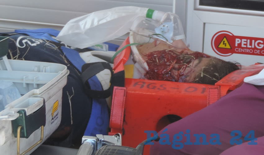 Este mujer, cuyo estado de salud es sumamente grave, fue arrollada por una de las unidades