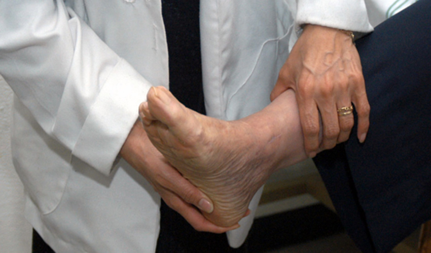 Las técnicas quirúrgicas modernas permiten que el paciente camine casi de inmediato con el uso de zapato post operatorio