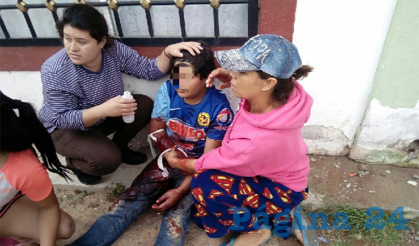 El pequeño de 10 años fue rescatado por policías preventivos, siendo llevado a un hospital para su curación