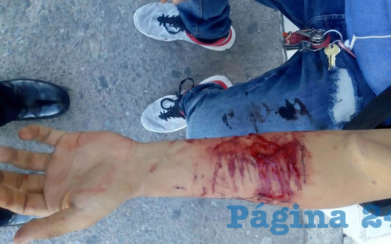 Las heridas que se produjo el joven