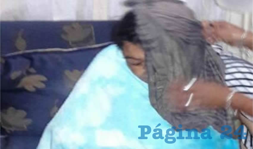 Alma Delia present&oacute; heridas en su rostro y un brazo