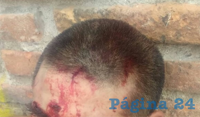 Federico sufrió traumatismo craneoencefálico