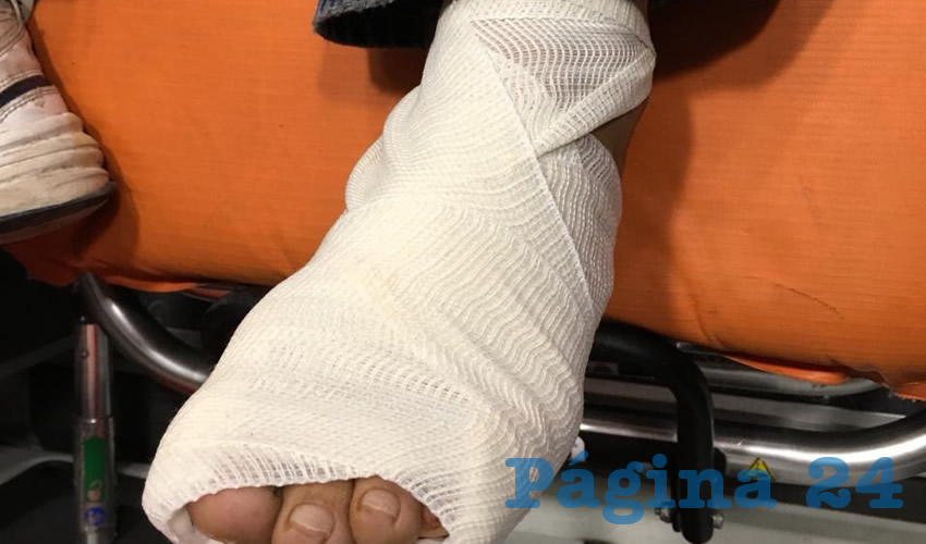 &ldquo;El Guacha&rdquo; s&oacute;lo present&oacute; un balazo en el pie izquierdo
