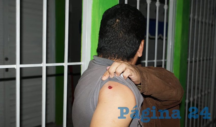 El ruletero Ramón Chanón sólo presentó un rozón de bala en el hombre derecho