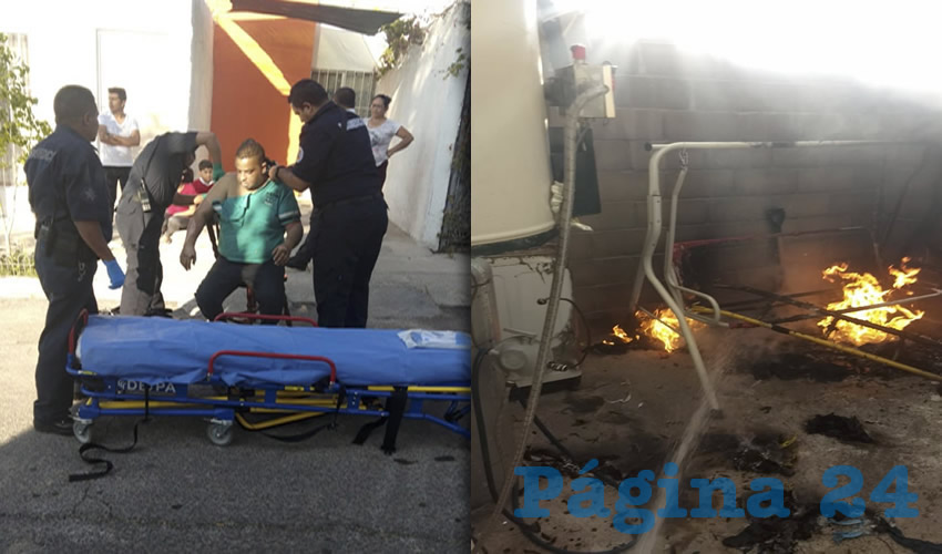 Erasmo Filemón García Rodríguez sufrió varias quemaduras al ocurrir el percance en el patio de su domicilio