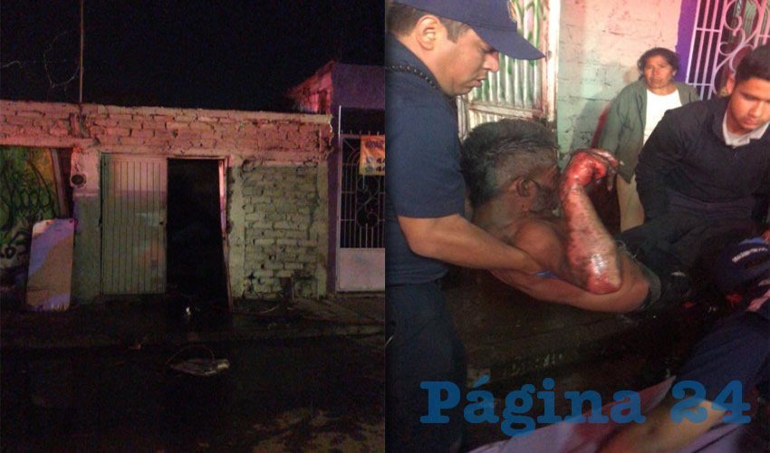 El fuego se desat&oacute; en la vivienda situada en calle L&aacute;zaro C&aacute;rdenas 248; la v&iacute;ctima sufri&oacute; quemaduras de primero y segundo grado