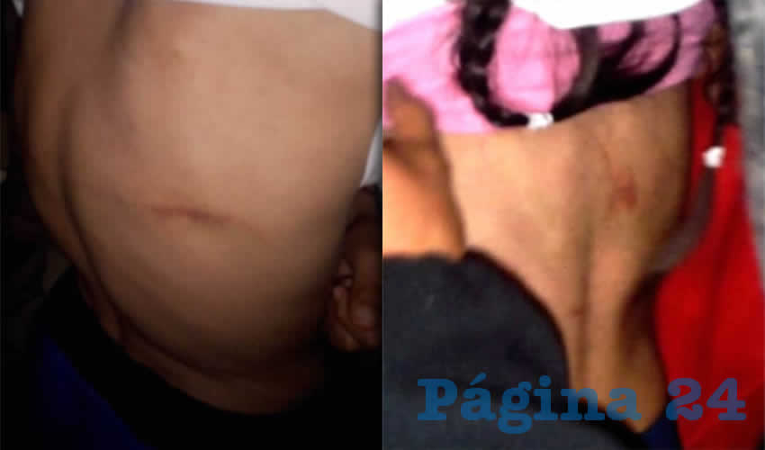 Algunos de los golpes que sufrieron los menores