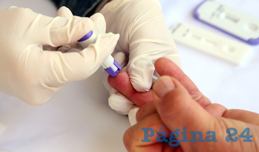 En Aguascalientes hay registro de 560 pacientes con VIH