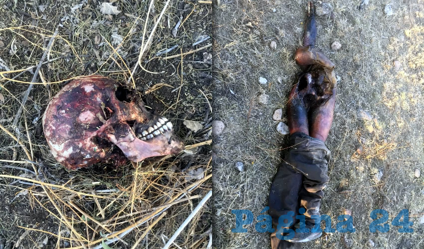 El cráneo y las piernas de la infortunada víctima, cuyo nombre aún se desconoce