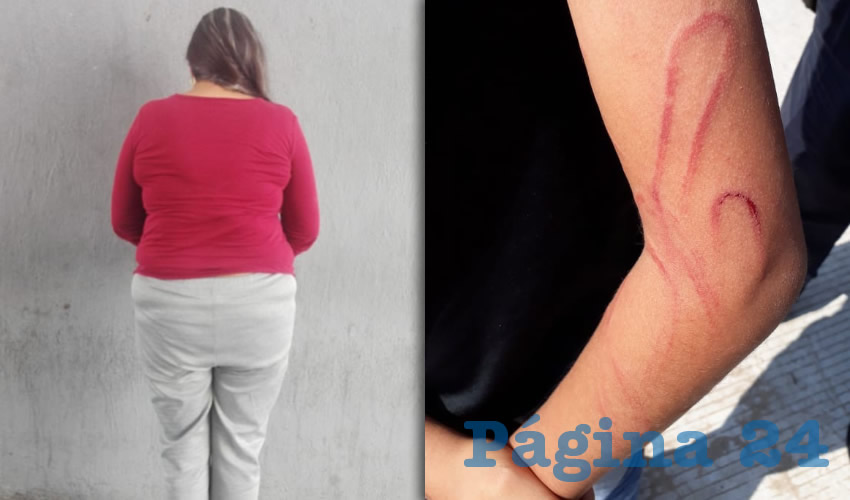 Mar&iacute;a Guadalupe y algunas de las heridas que provoc&oacute; a su hijo