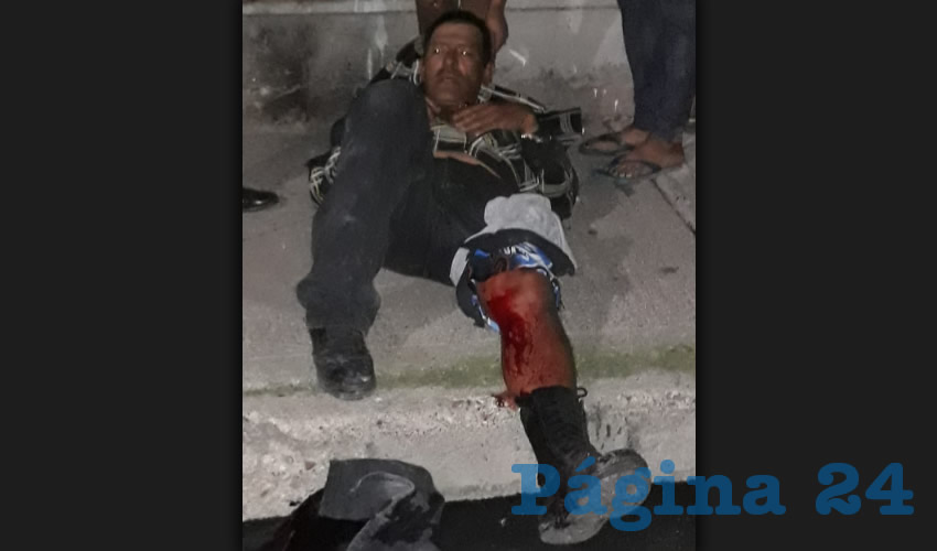 Julio César Gómez Esparza sufrió un balazo en la pierna izquierda
