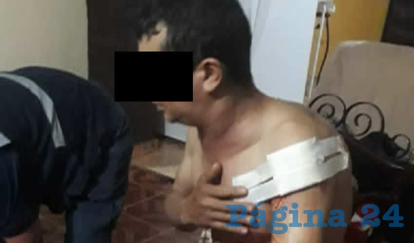 César Flores Esparza, de 38 años, fue agredido en Calvillo