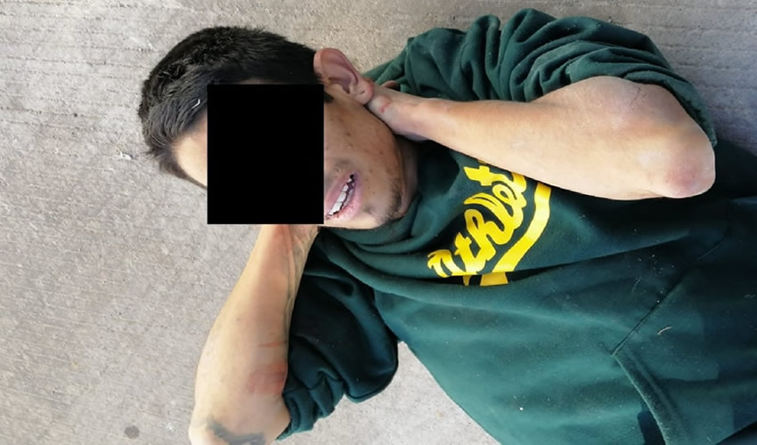 Erick Fernando Magdaleno Paredes fue herido de bala en una pierna luego de que amenazara con un cuchillo a uniformados
