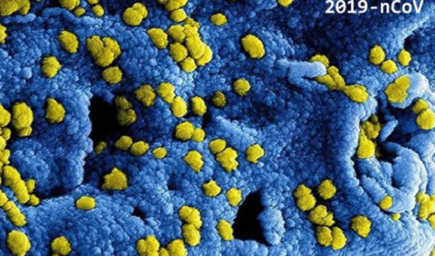 “Nuevo Coronavirus”, imagen de laboratorio (Foto: Especial)
