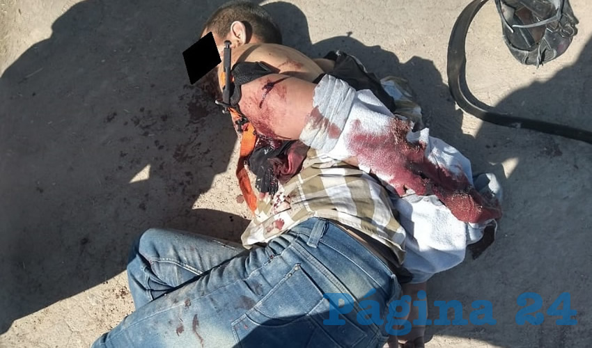 Uno de los detenidos, quien fue baleado en el brazo izquierdo