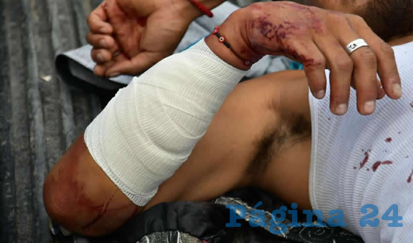 José Armando “N” “N”, de 23 años de edad, fue atendido por paramédicos, pero no fue necesario hospitaliarse