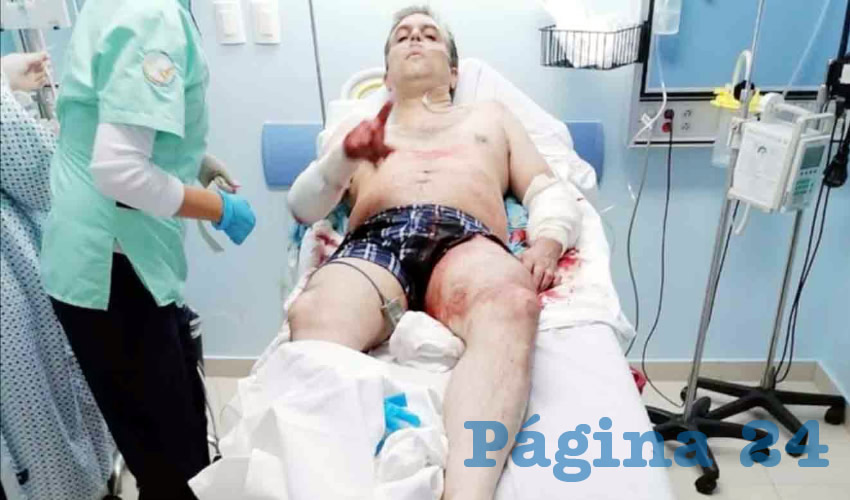 El regidor de Tlaquepaque por Morena, Alberto Alfaro, se encuentra estable luego de haber recibido 4 balazos afuera de un restaurante/Foto: Especial