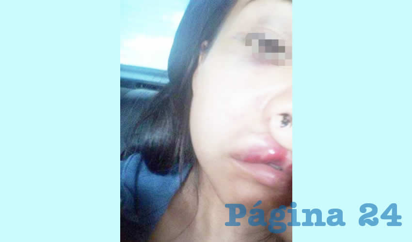 “Te llena de mucha indignación porque de por sí ir a denunciar es muy traumático, y ver con desesperación cómo los fulanos (en la fiscalía) se ríen, que no hagan nada es lo que desmotiva”, lamentó familiar de una joven que fue golpeada a puñetazos por su esposo, en la colonia Miravalle/Foto: Francisco Tapia