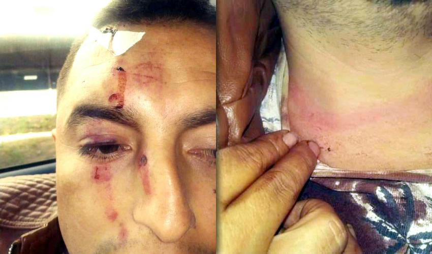 La víctima muestra los golpes que sufrió en el rostro