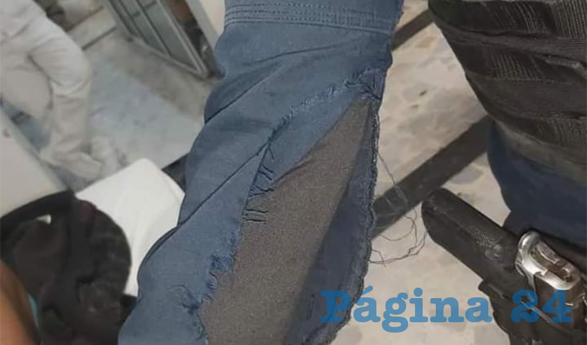 A una policía le rompieron la manga de su uniforme y el cierre de su chaleco antibalas, mientras que su compañero presenta un golpe en la boca/Fotos: Cortesía